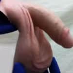 imagen primera protesis de un pene en el mundo